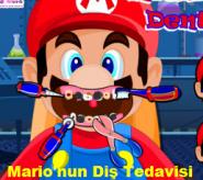 Mario'nun Diş Tedavisi